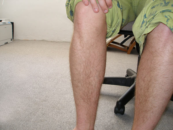 File:Adolescent leg hair.jpg