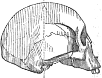File:Eskimo skull Mongoloid 2.png