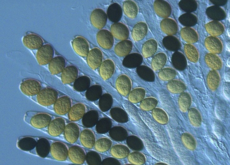 File:Linear arrangement of ascospores in the asci of the fungus Sordaria macrospora Cropped.jpg