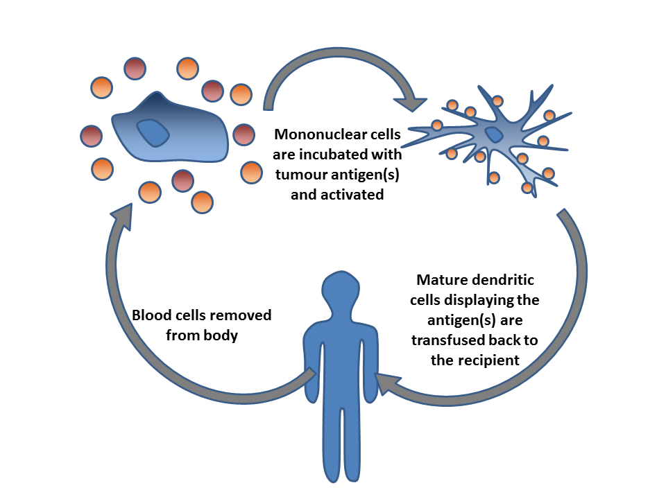 File:Dendritic cell therapy.png - Wikipedia
