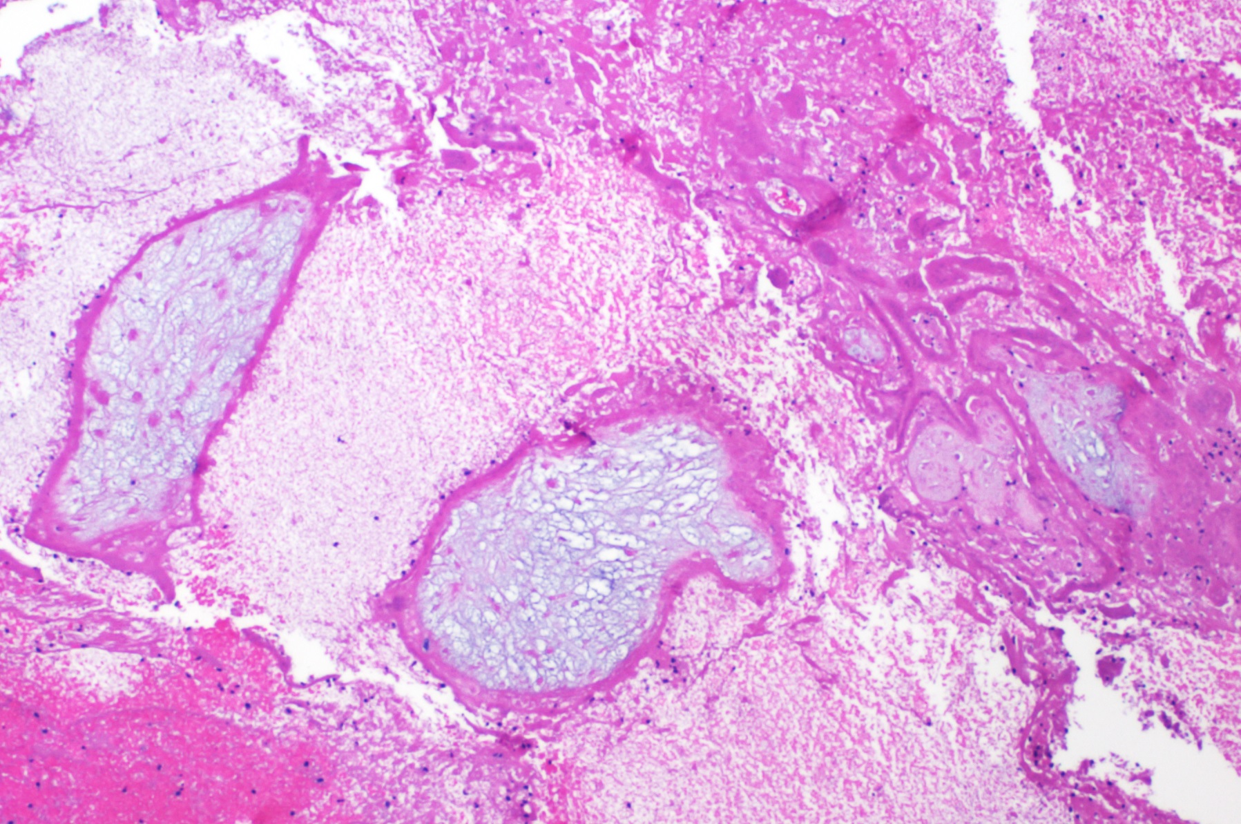 chorionic villi histology