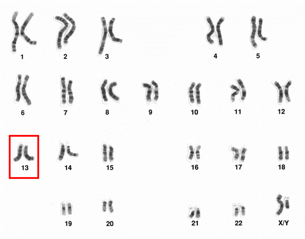 Chromosome 13 Wikipedia