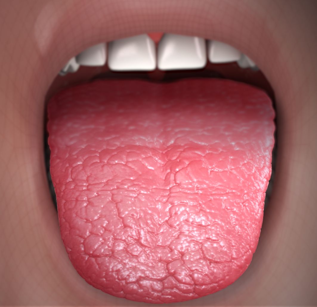 dehydration symptoms tongue