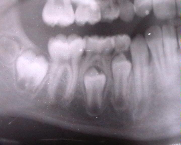 File:Dentition1.JPG