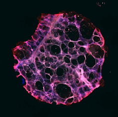 <span class="mw-page-title-main">Precision cut lung slices</span> Thin sections of lung tissue used in respiratory research