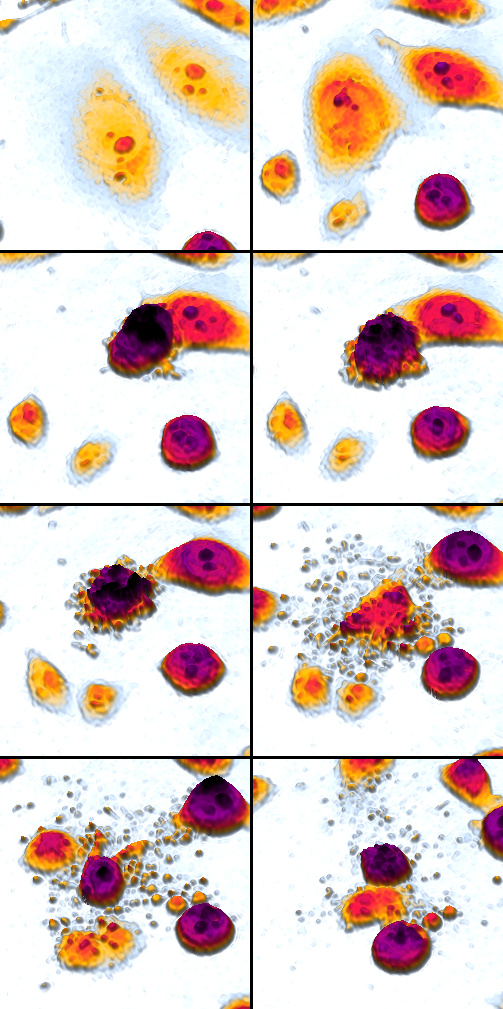 Apoptosis DU145 cells mosaic.jpg