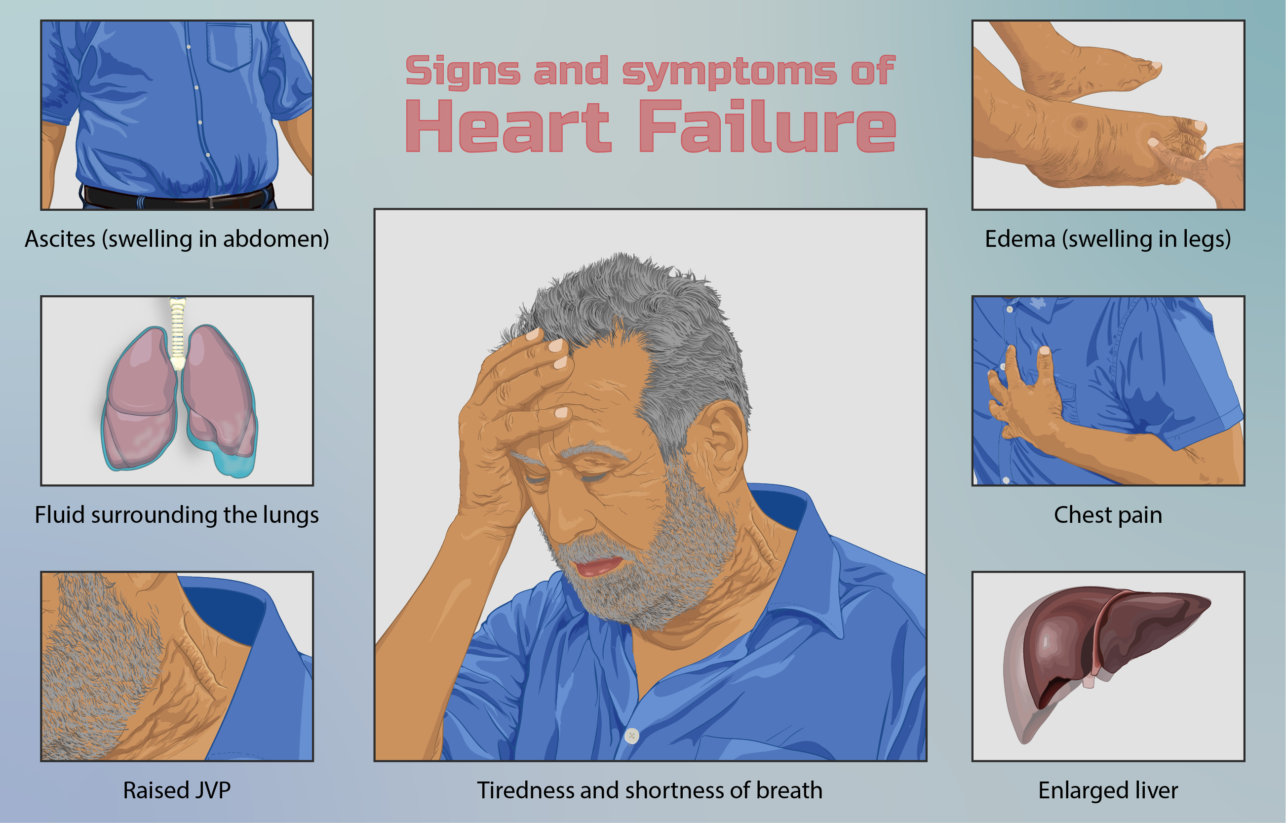 Symptoms of a heart failure