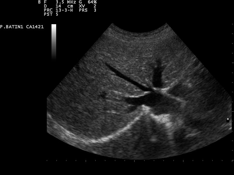 File:Ultrasound Scan ND 0128141905 1420530.png