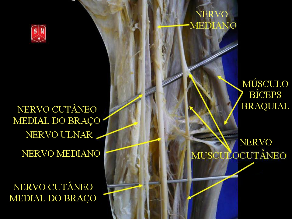 Brachial veins - Wikipedia