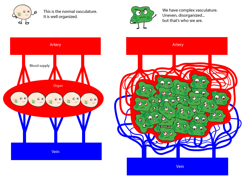 File:Comparison between normal and tumor vasculature.jpg