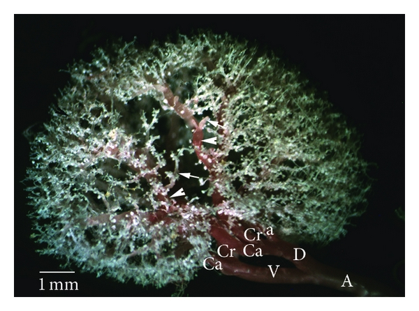 File:Dorsal-view-of-the-intrarenal-branches-of-the-renal-arteries-Type-Ib.jpg