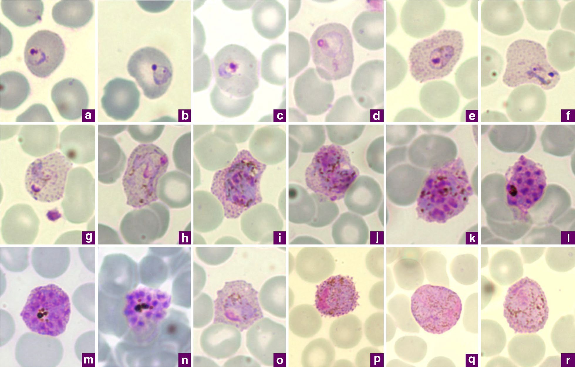 Plasmodium vivax- Life Cycle in Man and in Mosquito