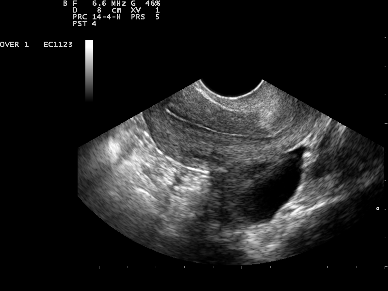 File:Ultrasound Scan ND 0124144905 1453160.png
