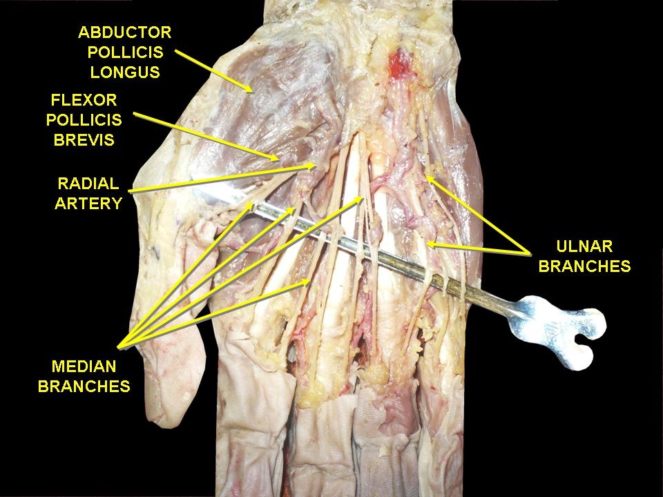 File:Branches of median nerve.jpg - Wikimedia Commons