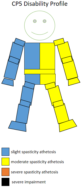 The spasticity athetosis level and location of a CP5 sportsperson. CP5 disability profile.png