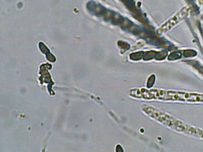 File:Hypoxylon fuscum asci, Gladde kogelzwam sporenzakjes.jpg