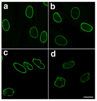 Laminopathic nuclei.jpg