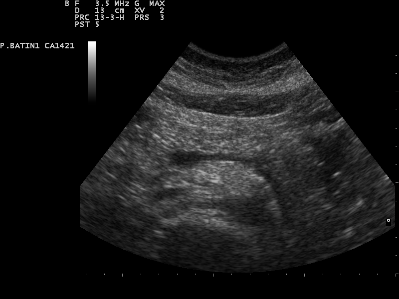 File:Ultrasound Scan ND 0118081443 0820170.png