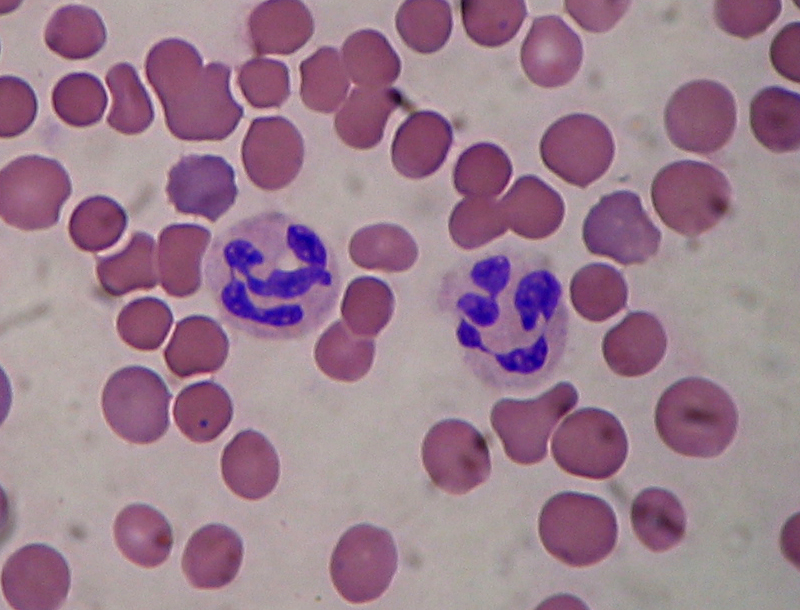 Neutrolphils