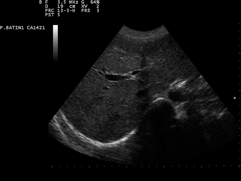 File:Ultrasound Scan ND 0126081552 0821290.png