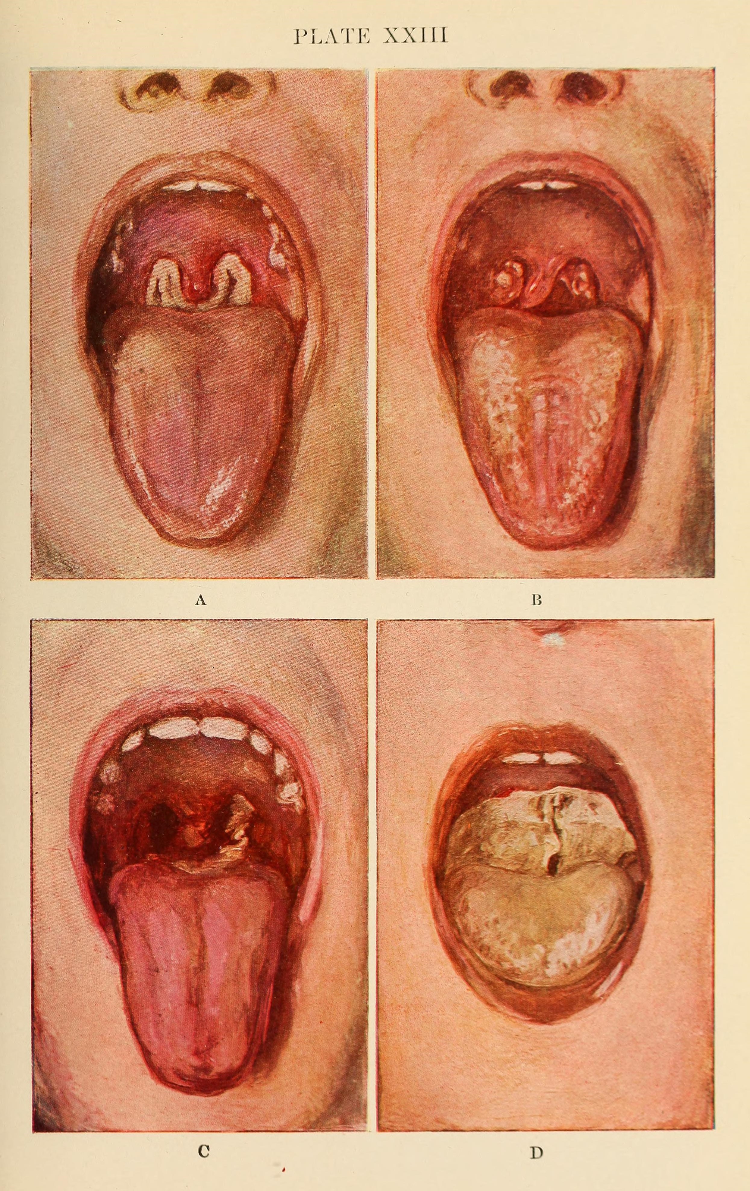 File Diseases of infancy and childhood 1914 14585319350 .jpg