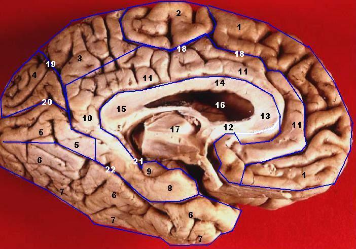 File:Human brain inferior-medial view description 2.JPG