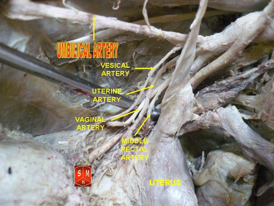 umbilical arteries