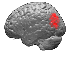 Brodmann area 39 brain area