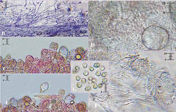 File:Amanita coryli, Цветне ливаде, 02.09.2020 (microscopy).png