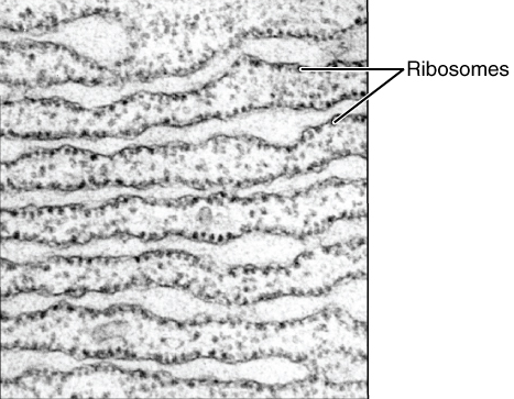 endoplasmic reticulum micrograph