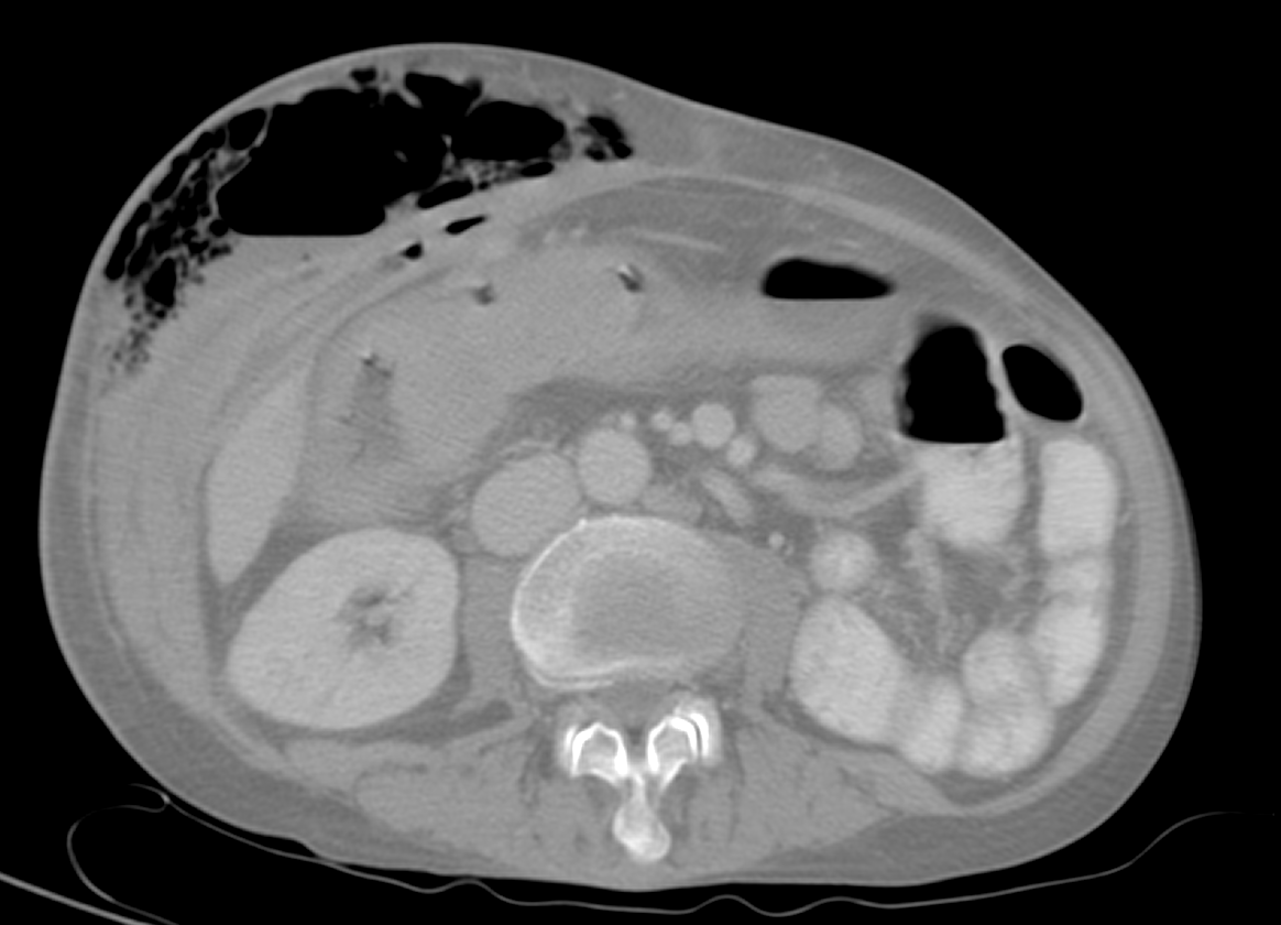 Cassia fistula - Wikipedia