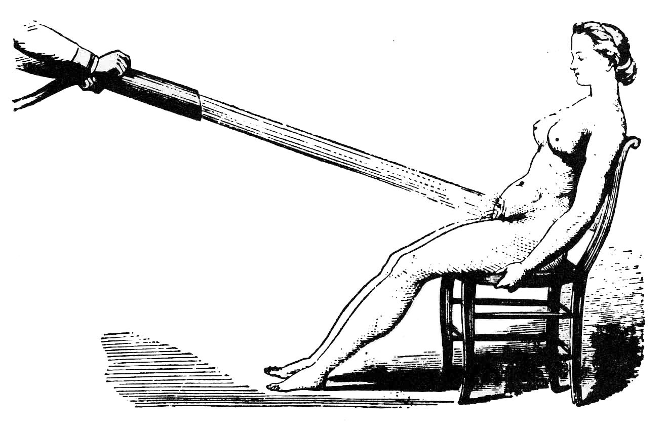 Fransız pelvik duş (pelvik masaj) cihazı, 1860