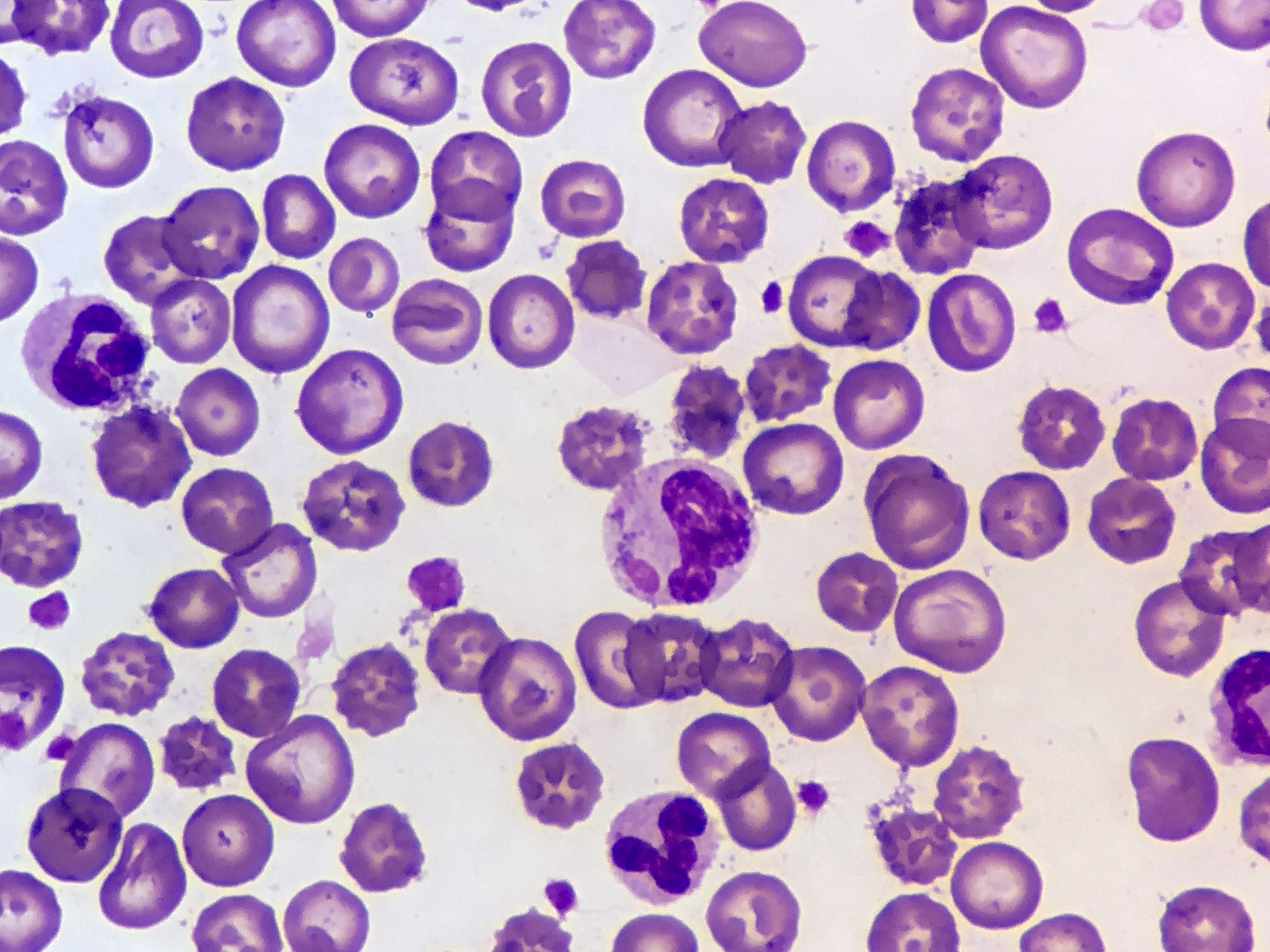 File:Canine Distemper Virus Cytoplasmic Inclusion Body ...