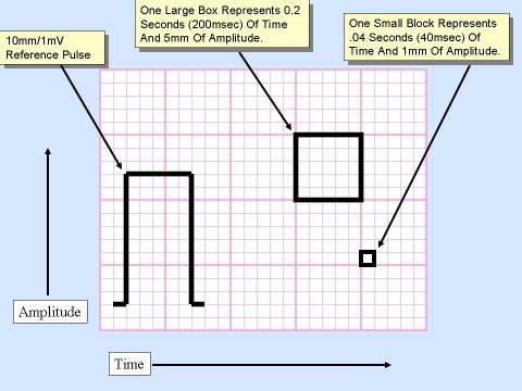 Electrocardiography - Wikipedia