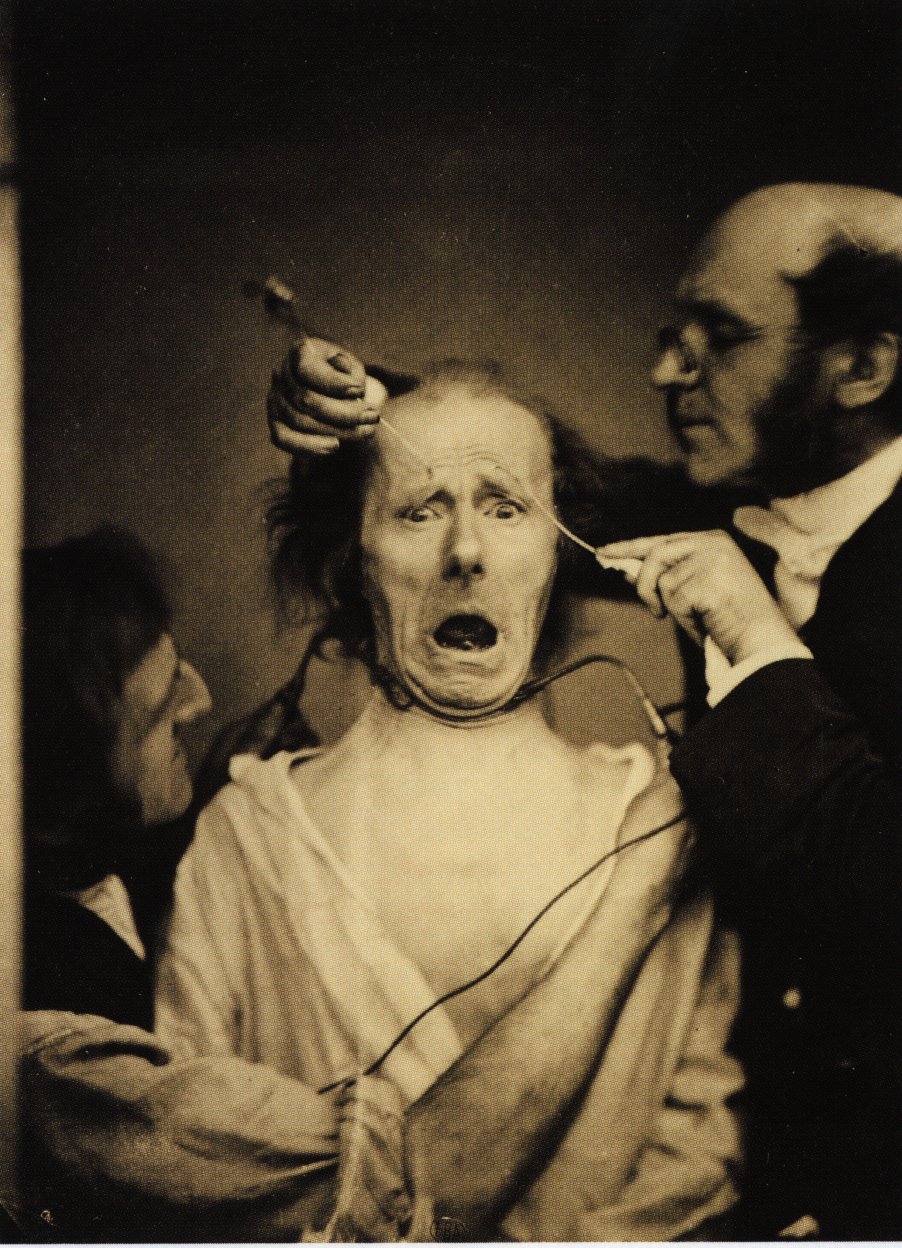 https://upload.wikimedia.org/wikipedia/commons/3/32/Guillaume_Duchenne_de_Boulogne_performing_facial_electrostimulus_experiments.jpg