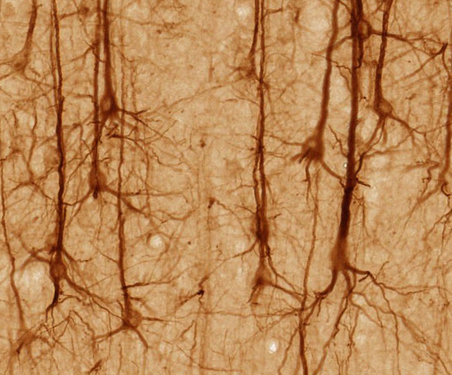 Neuron, from Wikipedia