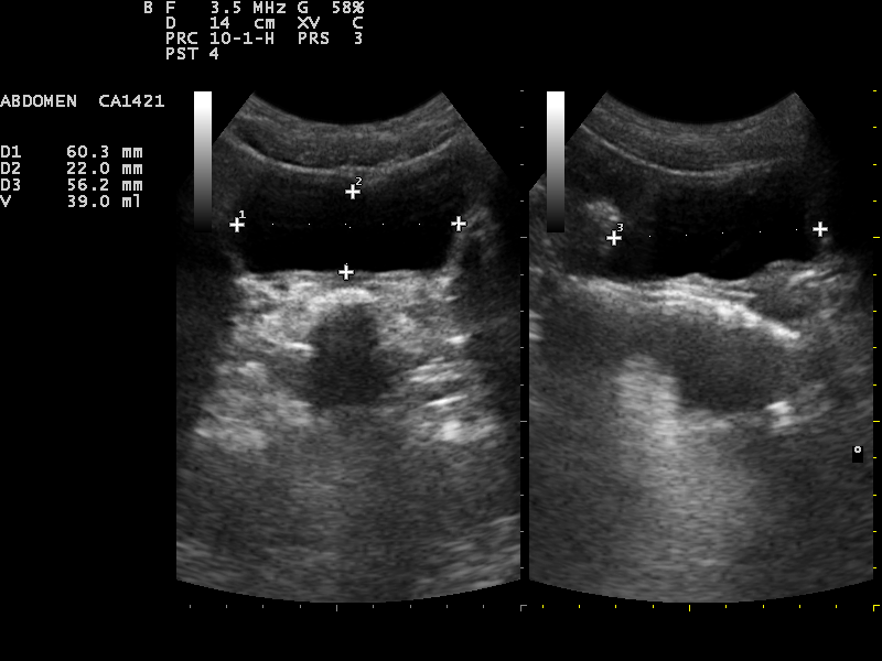 File:Ultrasound Scan ND 0107114845 1150530.png