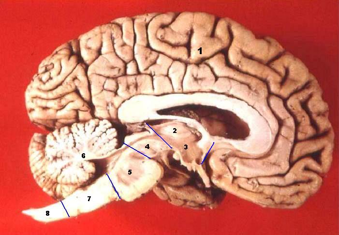 File:Human brain midsagittal cut description.JPG