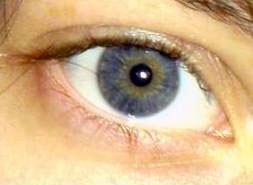 File:A blue eye.jpg - Wikipedia