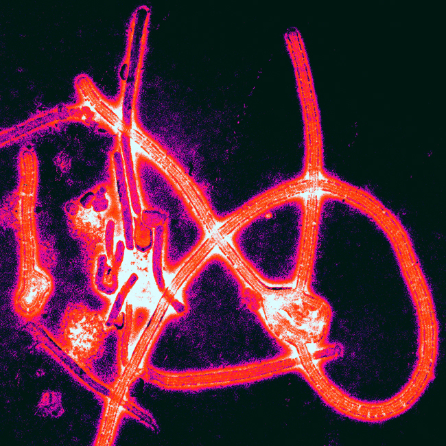 Ebola virus particles.jpg