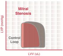 Pressure–Volume Loop Analysis In Cardiology