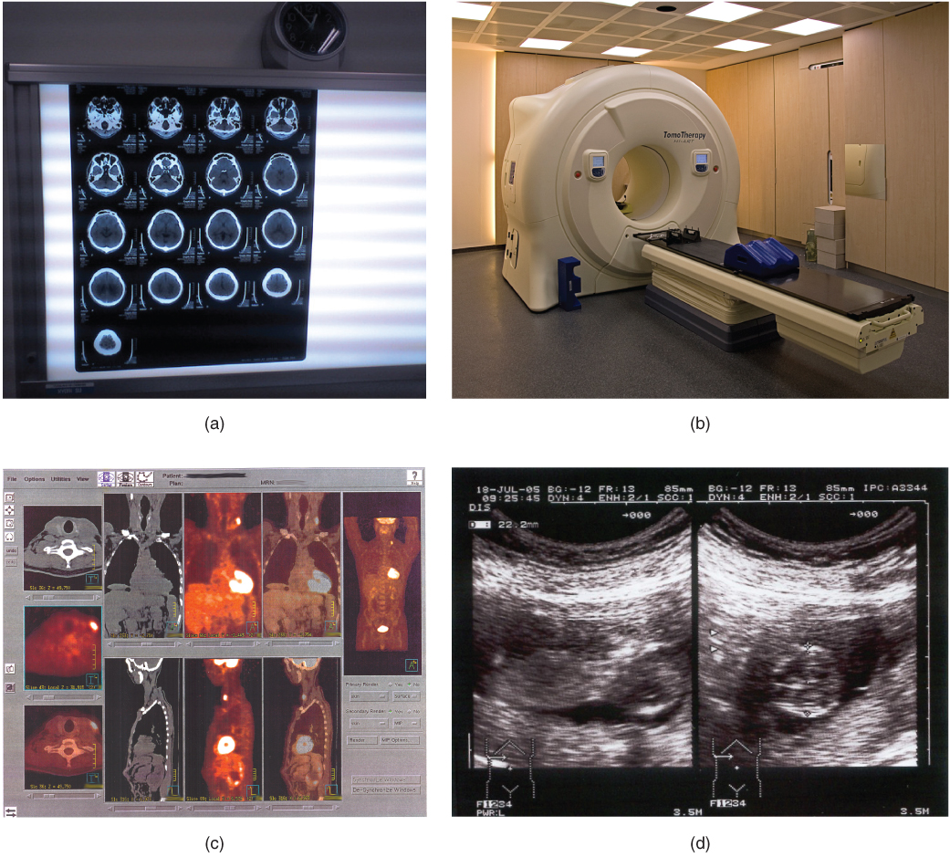 unitom #diagnósticoporimagem #tomografia #ressonânciamagnética #cascavelpr, By Unitom - Diagnóstico por Imagem