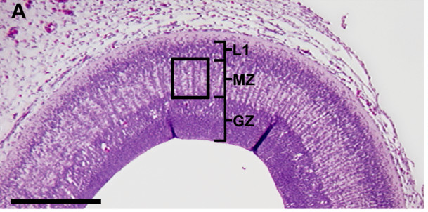 File:HE stain murine optic tectum.jpg