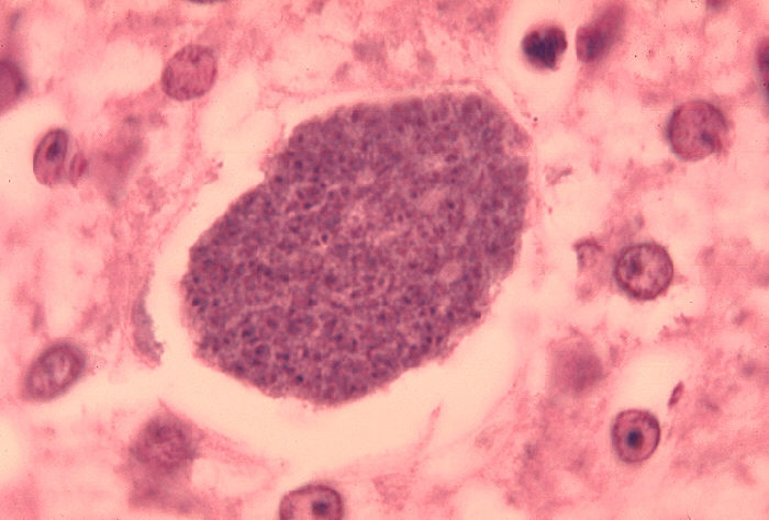 File:Histopathology of malaria exoerythrocytic forms in liver 07G0024 lores.jpg
