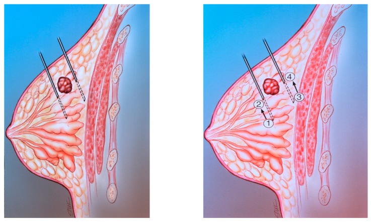 File:Diagnostics-09-00012-g011.jpg