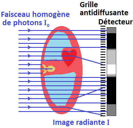 File:Principe de la radiographie.png