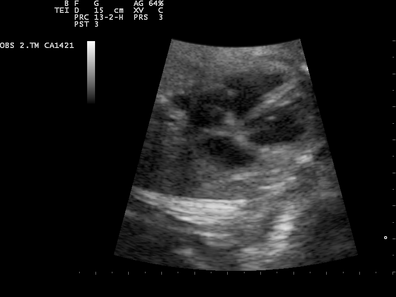 File:Ultrasound Scan ND 0126102338 1029270.png