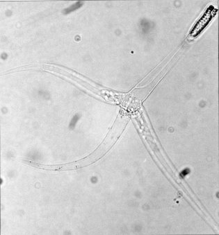 myxozoan paraziták)