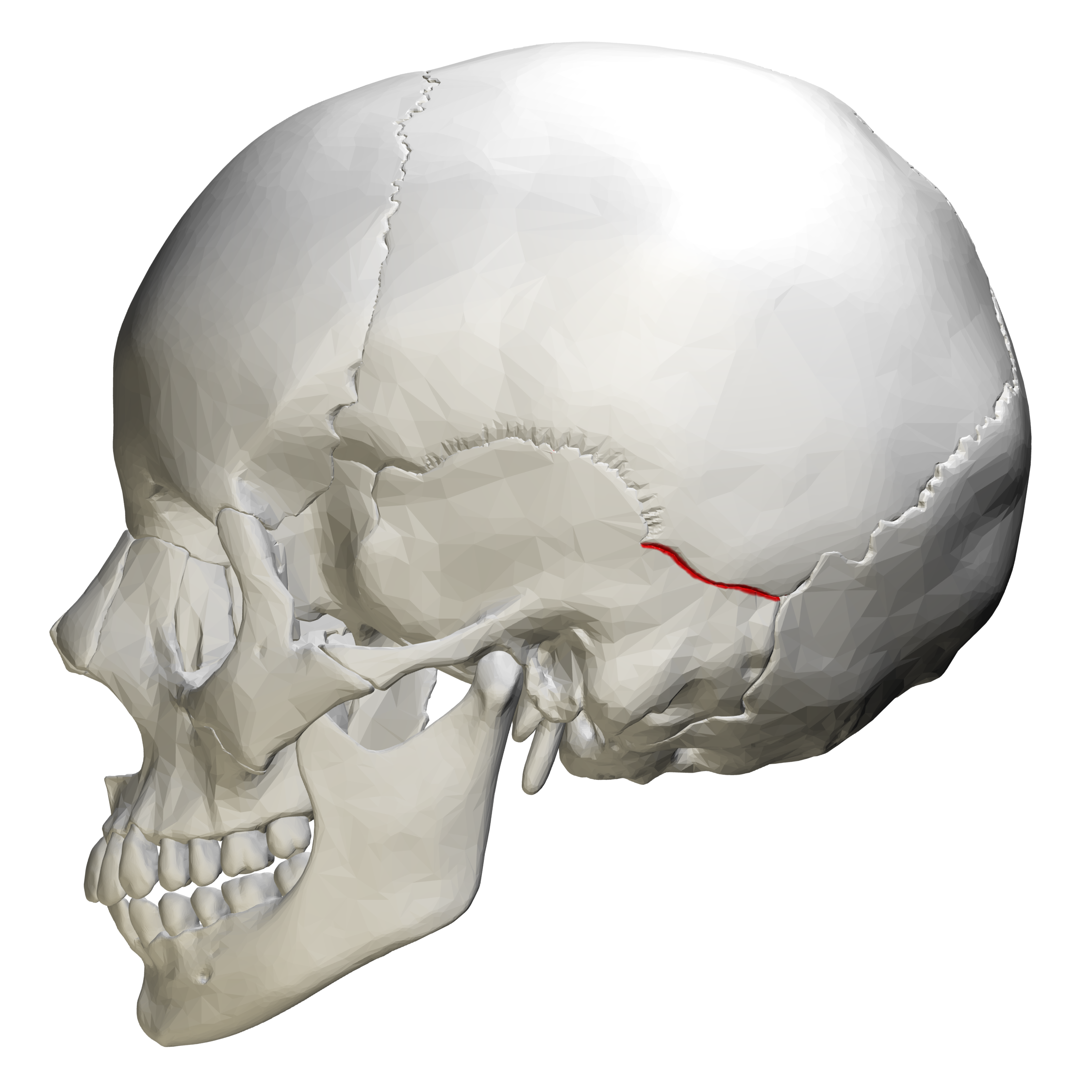 parietomastoid suture