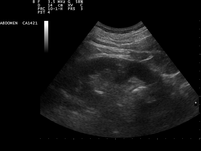 File:Ultrasound Scan ND 0110145312 1454460.png